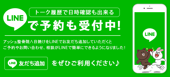 アッシュ整骨院∧日焼けをLINEでお友だち追加していただくと、ご予約やお問い合わせ、相談がLINEで簡単にできるようになりました！LINEで予約はじめました！LINEで予約ができます！